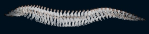 spine medtronic        